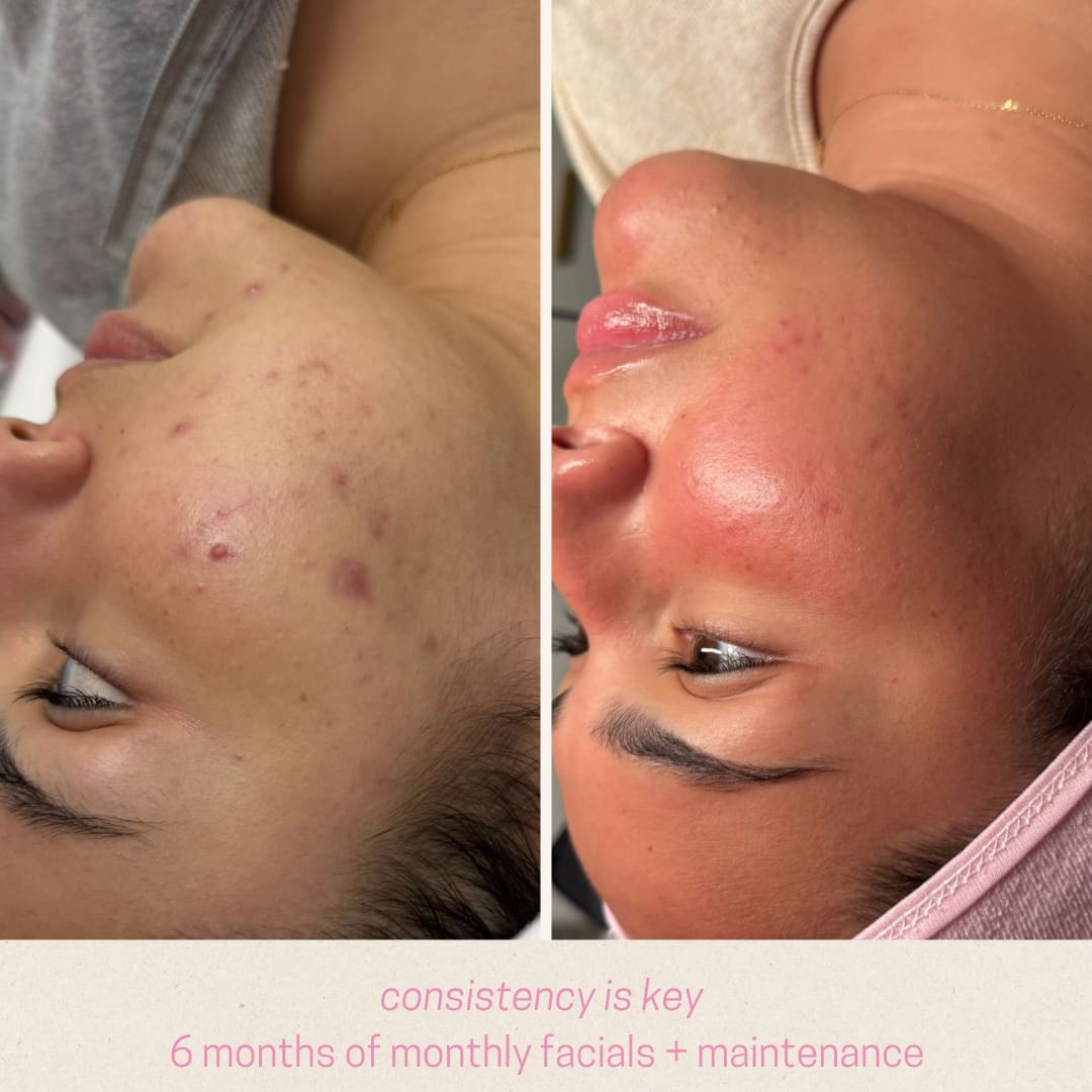 Skincare treatment at Metairie Med Spa